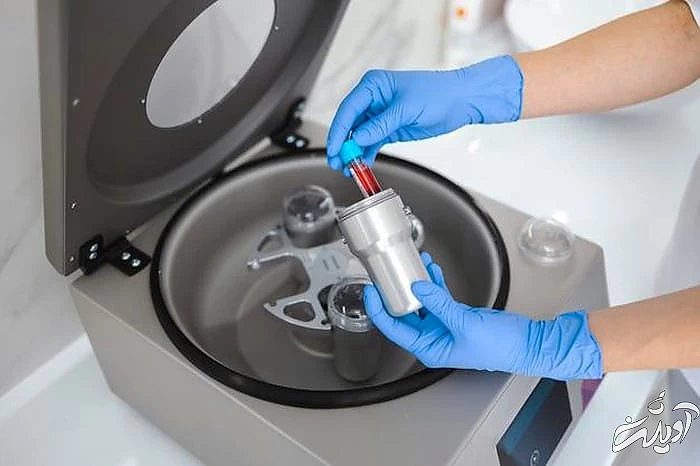 دستگاه سانتریفیوژ 